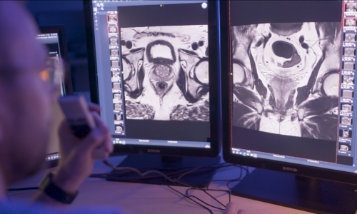 Supporting trials of AI in prostate cancer testing